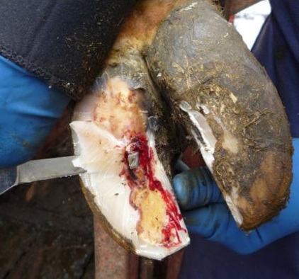 A double sole caused by pus tracking to the toe.